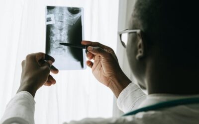 How to Successfully Make a Claim for a Spinal Cord Injury